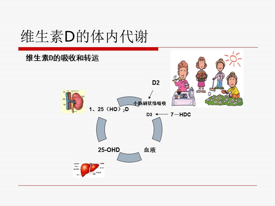 小儿佝偻病的护理.ppt_第3页