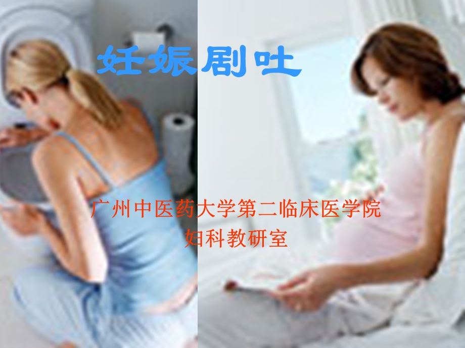 妊娠病妊娠剧吐.ppt_第1页