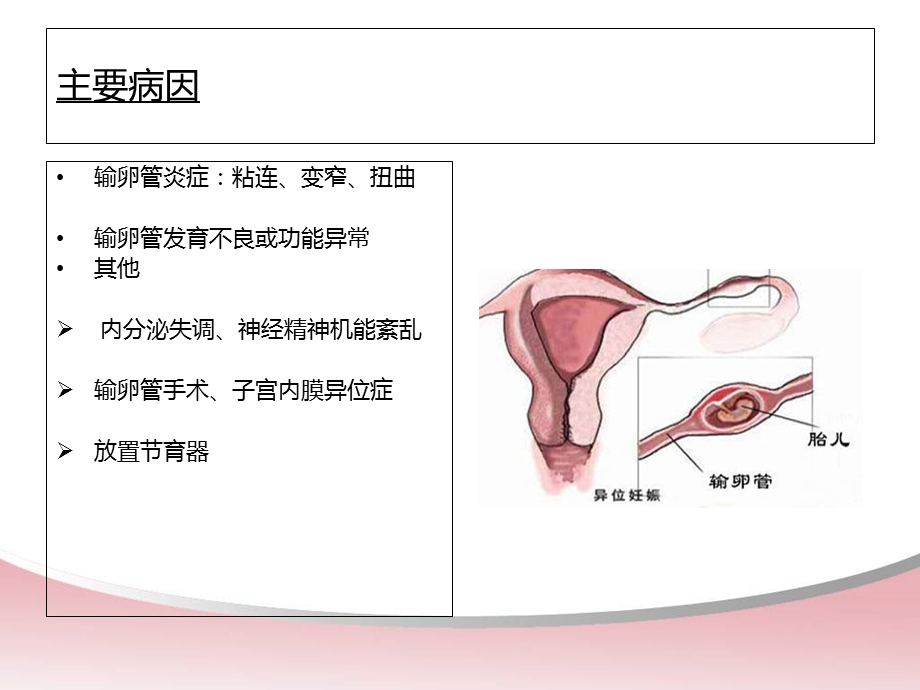 宫外孕腹腔镜术前术后的护理.ppt_第3页