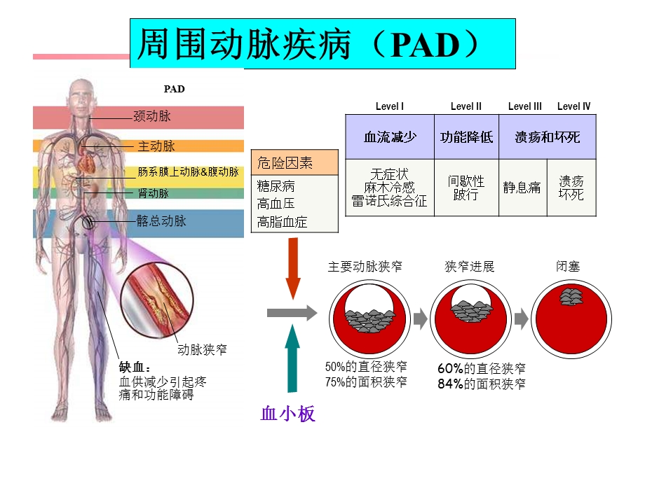 周围动脉疾病(PAD).ppt_第3页