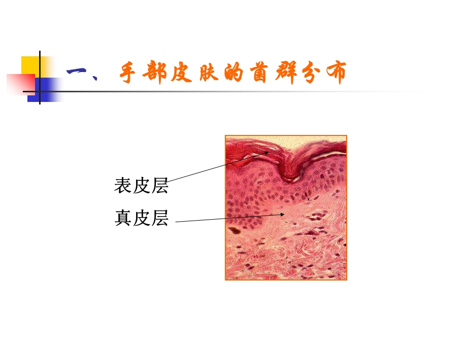 手卫生与医院感染的控制.ppt_第3页