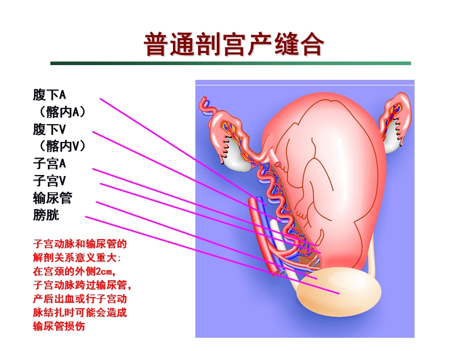 剖宫产手术缝合技术.ppt_第2页