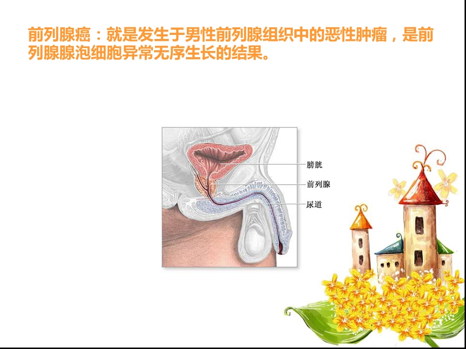 前列腺癌的护理查房.ppt_第3页