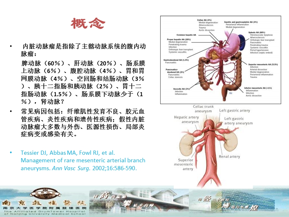 内脏动脉瘤的治疗.ppt_第2页