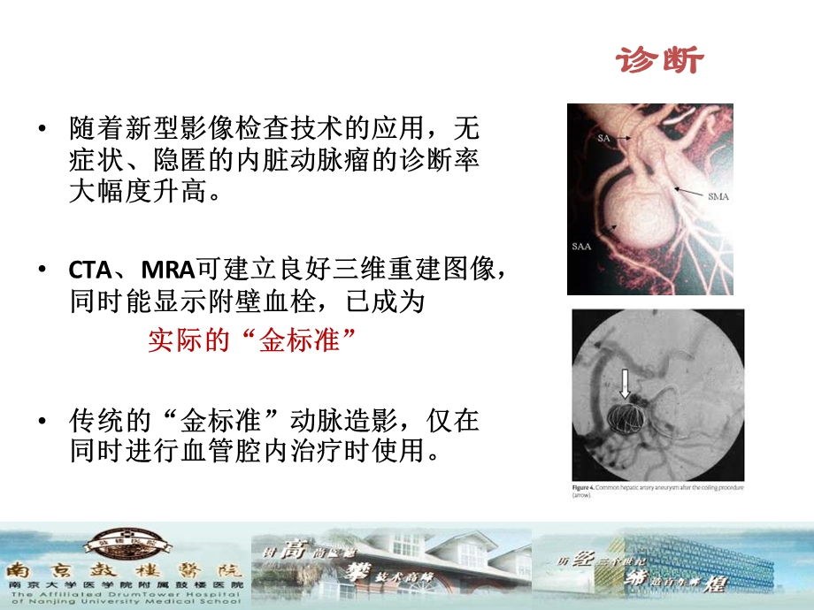 内脏动脉瘤的治疗.ppt_第3页