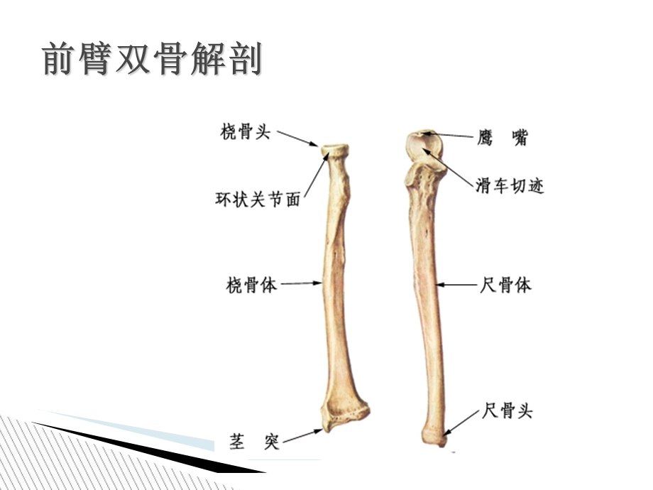 前臂双骨折的中医护理.ppt_第2页