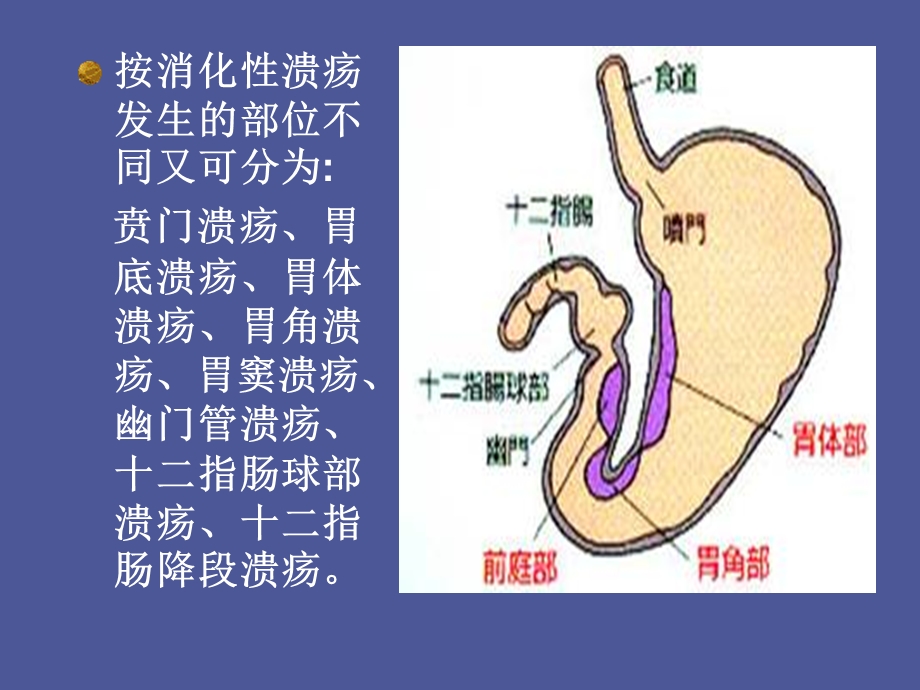 内科学消化性溃疡.ppt_第3页