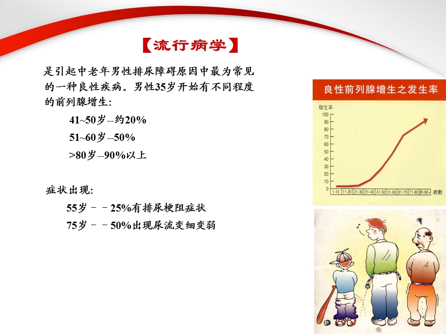 前列腺增生症.PPT.ppt_第2页