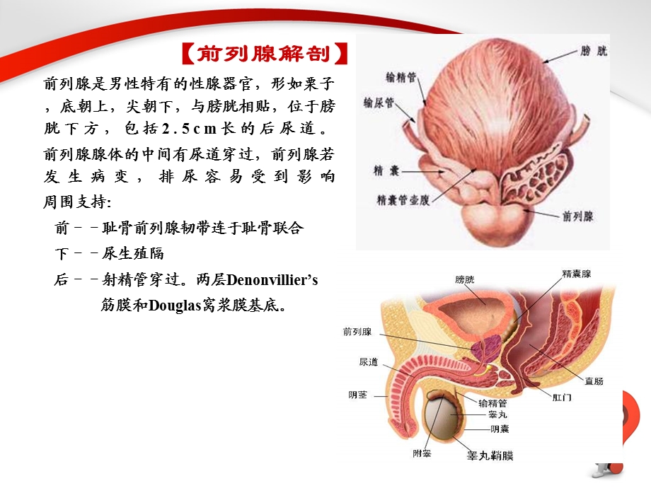 前列腺增生症.PPT.ppt_第3页