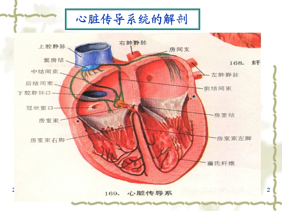 内科笔记-心率失常.ppt_第2页