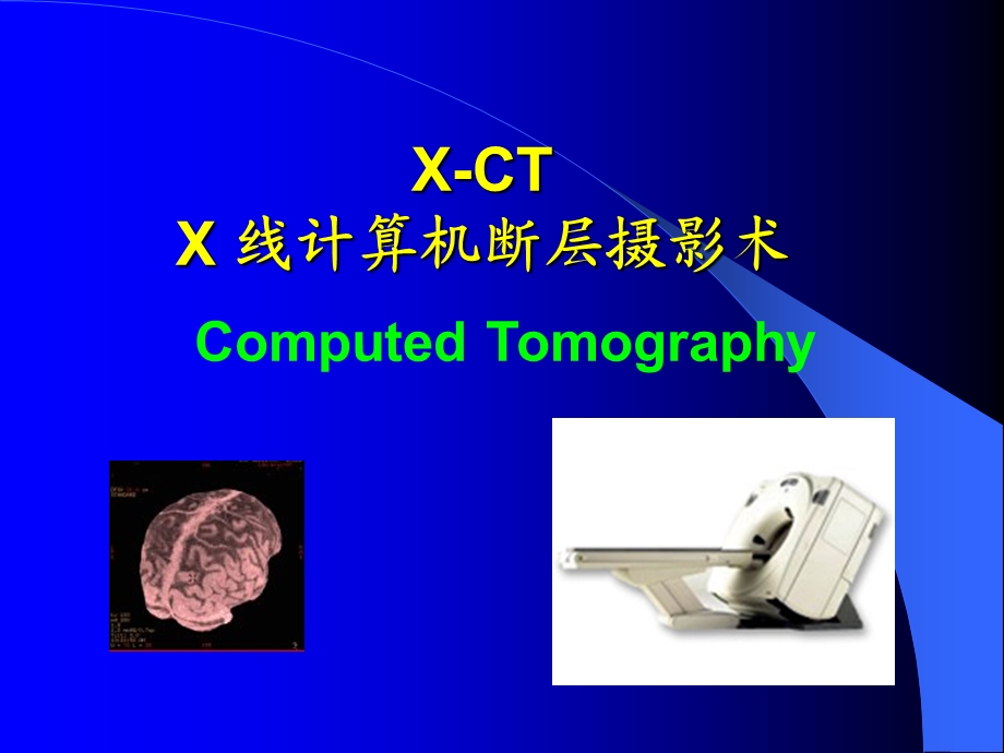 医学影像中的CT成像原理.ppt_第1页