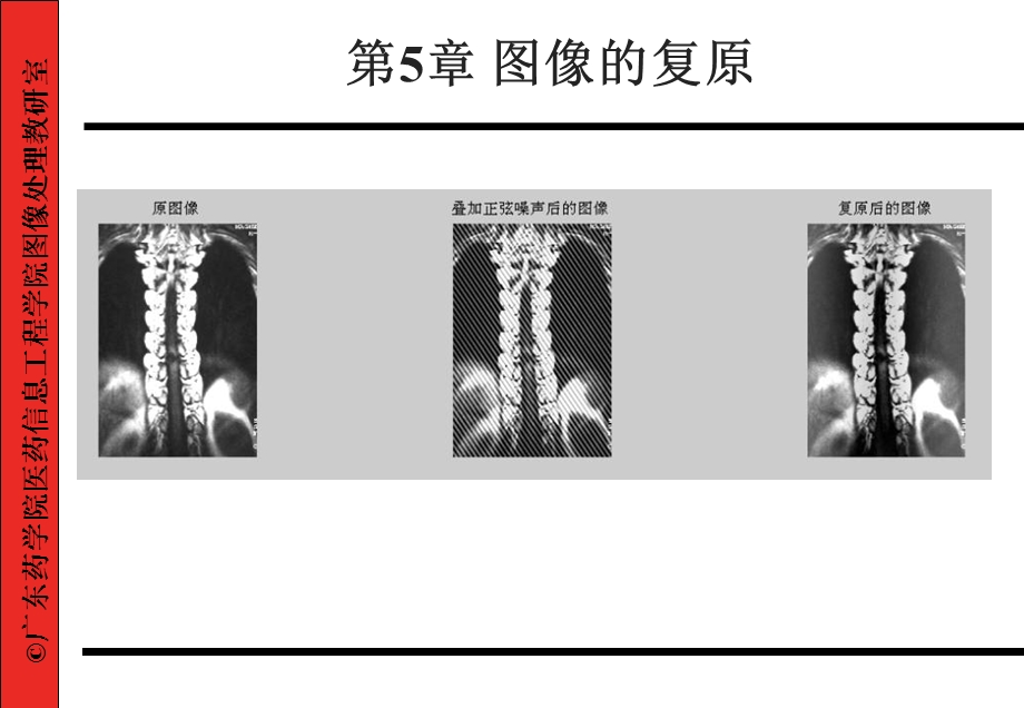 医学图像的复原.ppt_第1页