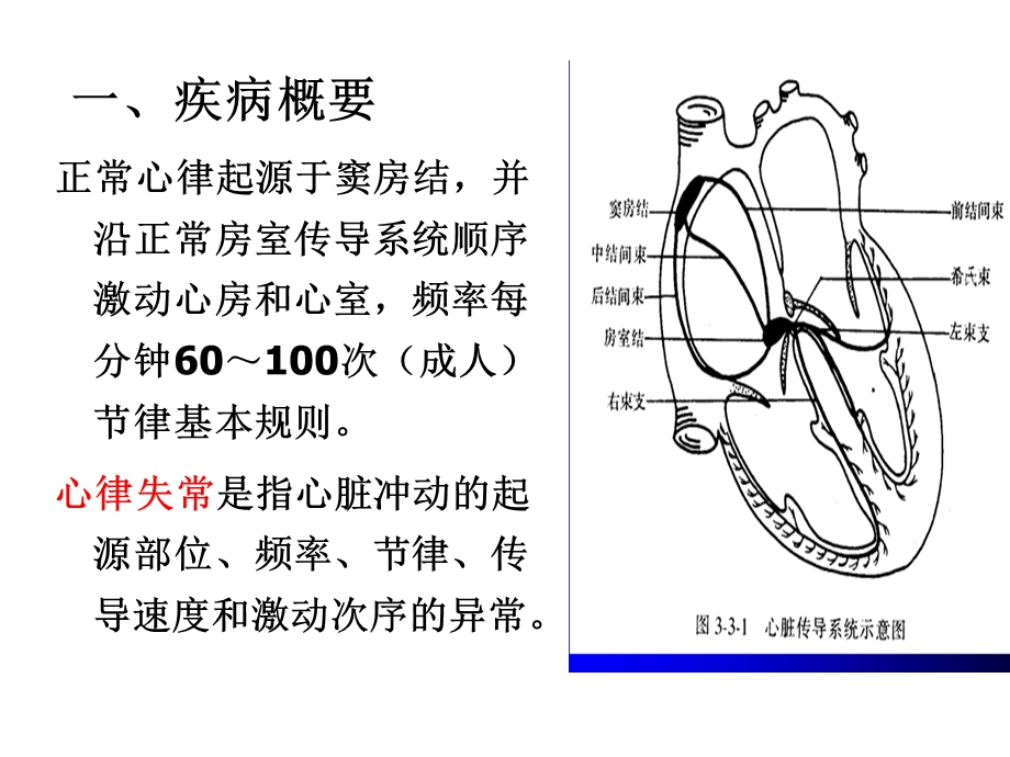 内科护理学-心律失常课件.ppt_第2页