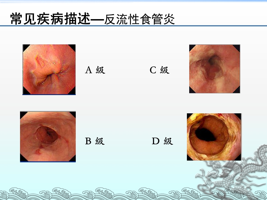 内镜报告书写规范.ppt_第3页