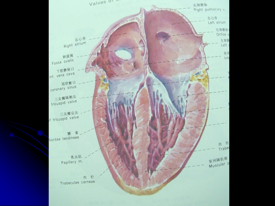 先天性心脏病房间隔缺损.ppt_第3页