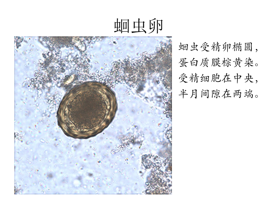 寄生虫学虫卵经典总结及图片.ppt_第1页