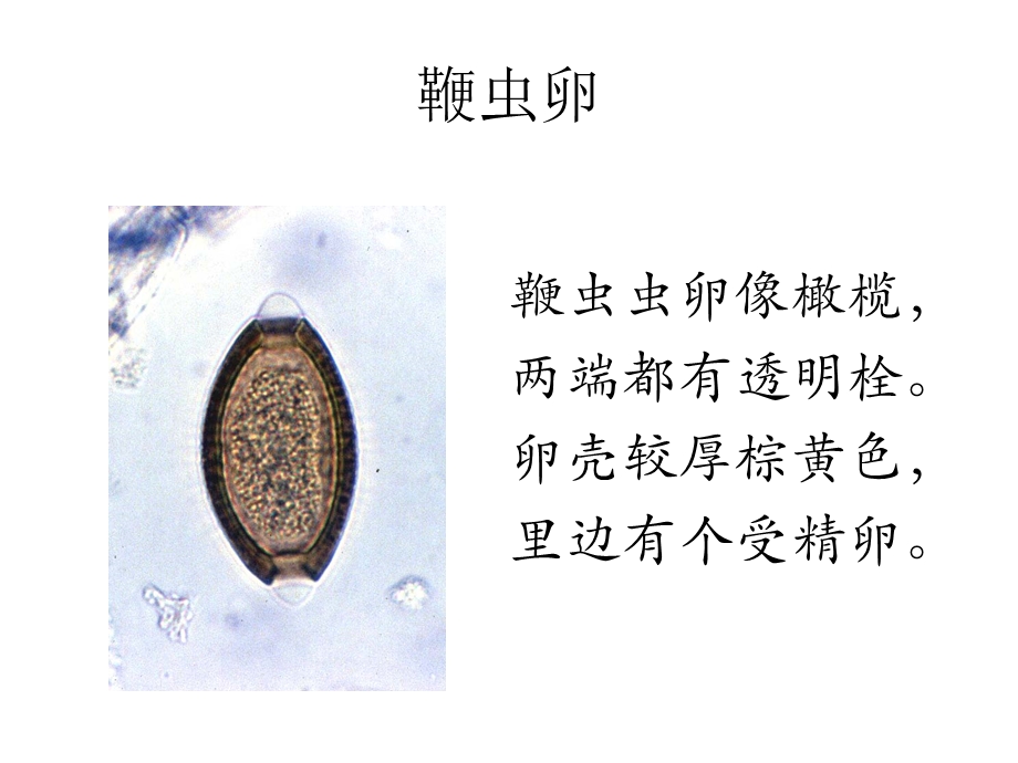 寄生虫学虫卵经典总结及图片.ppt_第3页