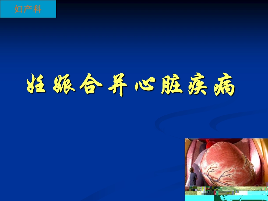 妊娠合并心脏疾病.ppt_第1页