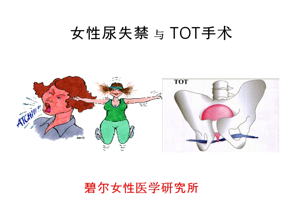 压力性尿失禁TOT治疗.ppt_第1页