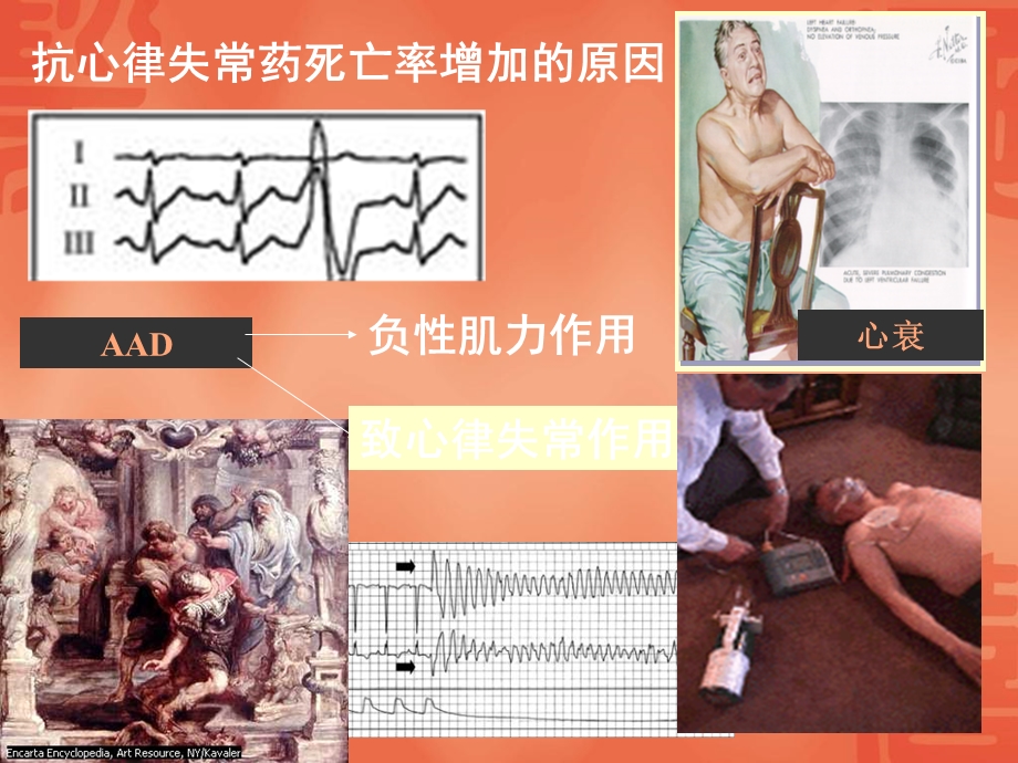 抗心律失常药的致心律失常作用.ppt_第3页