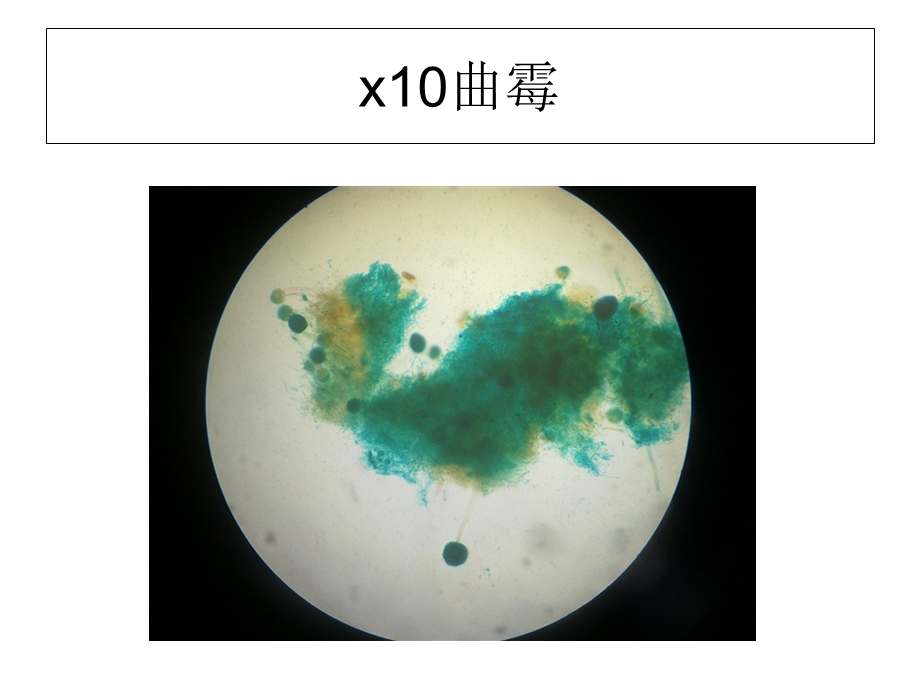 显微镜下霉菌(黑曲霉、根霉、青霉)形态观察.ppt_第1页