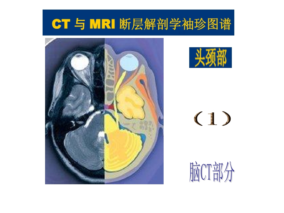 头颈CT-MRI解剖图解系列.ppt_第2页