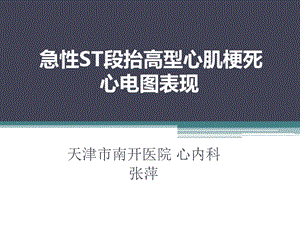 急性ST段抬高型心肌梗死心电图表现.ppt