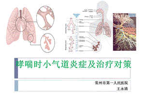 哮喘的小气道炎症(科内稿).ppt