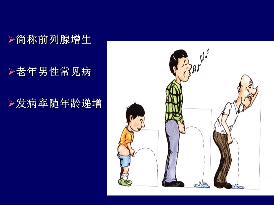 前列腺增生PPT课件.ppt_第3页