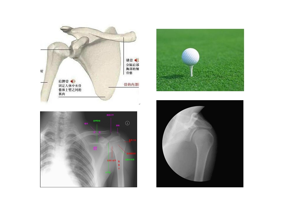 外科学(关节脱位).ppt_第2页