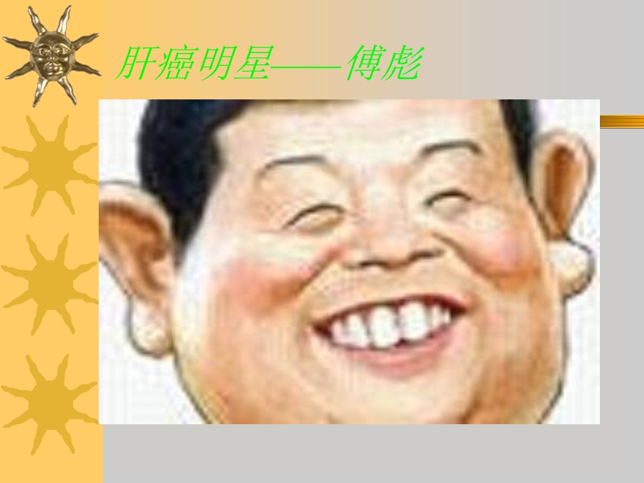 原发性肝癌相关.ppt_第2页