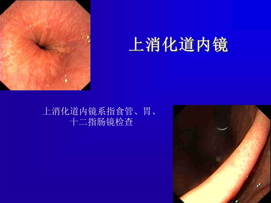 内镜的临床应用.ppt_第2页