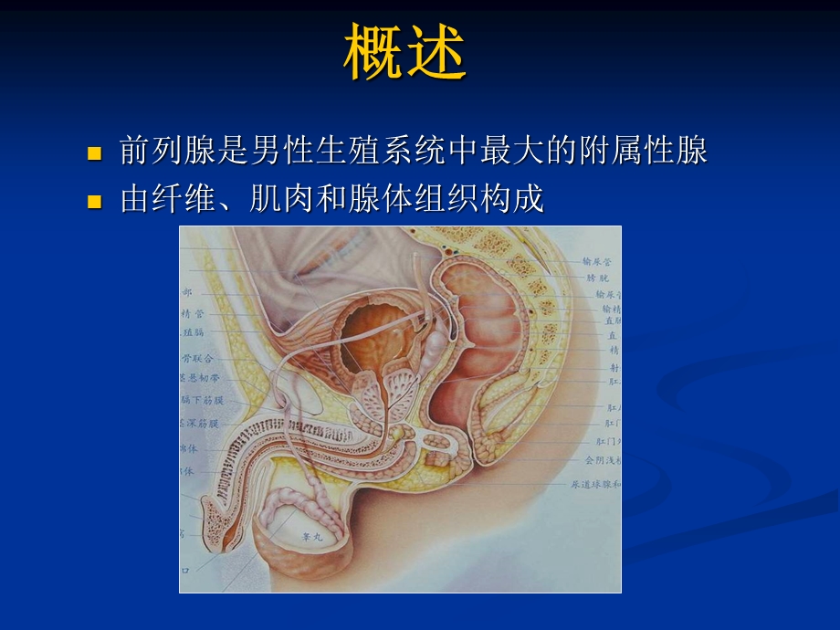 前列腺的MR检查.ppt_第2页