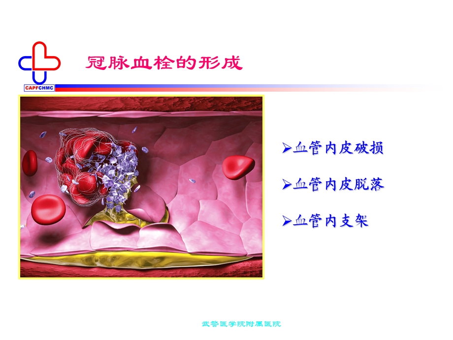 抗血小板药物应用.ppt_第3页