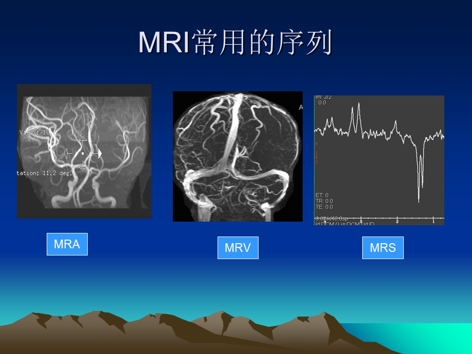 头颅MRI断层解剖.ppt_第3页