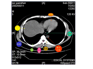 教你认识腹部CT.ppt