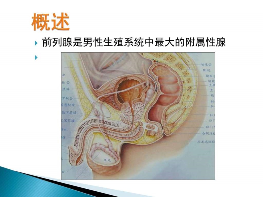 磁共振前列腺癌图文.ppt.ppt_第2页