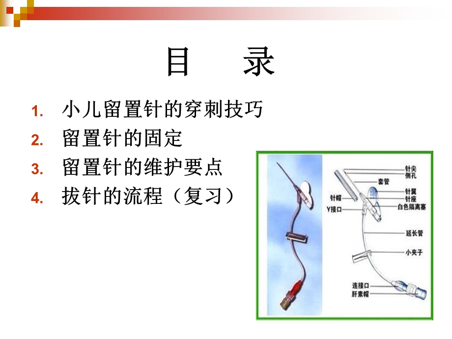 小儿留置针的穿刺技巧、固定与维护.ppt_第2页