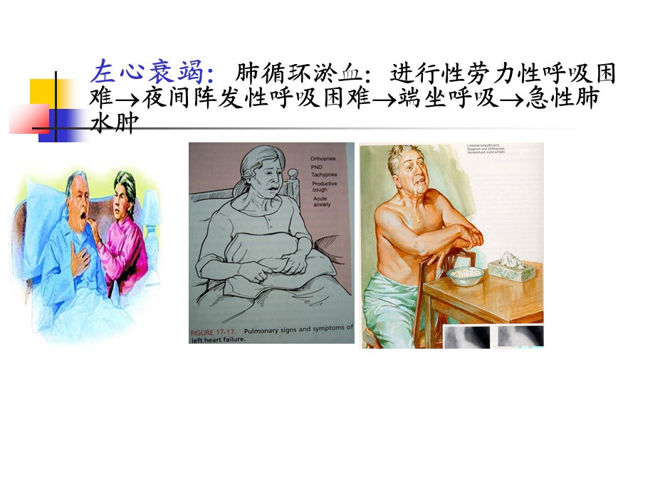 心衰的液体管理.ppt_第2页