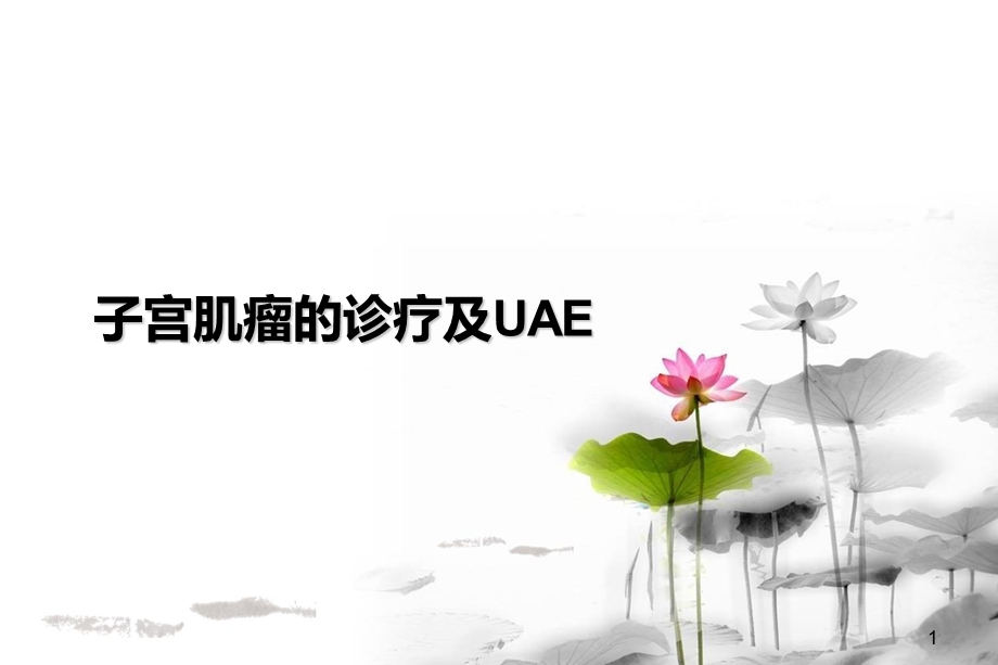 子宫肌瘤的诊疗.ppt_第1页