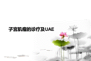 子宫肌瘤的诊疗.ppt