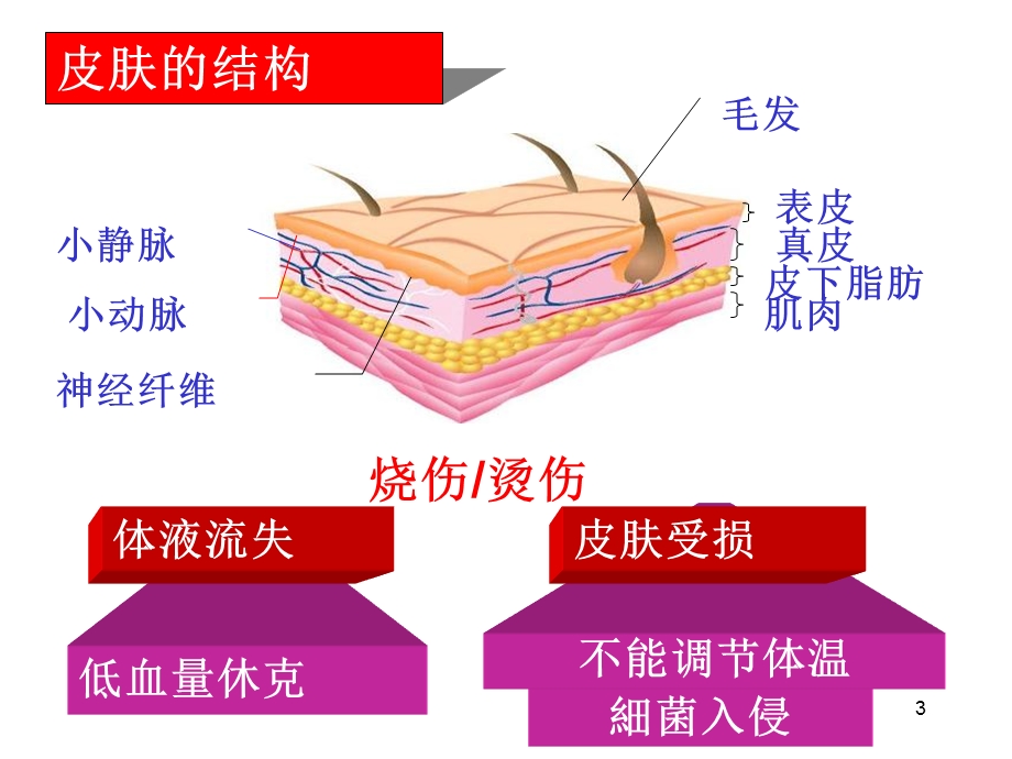 烧伤、烫伤和化学伤的基本处理.ppt_第3页
