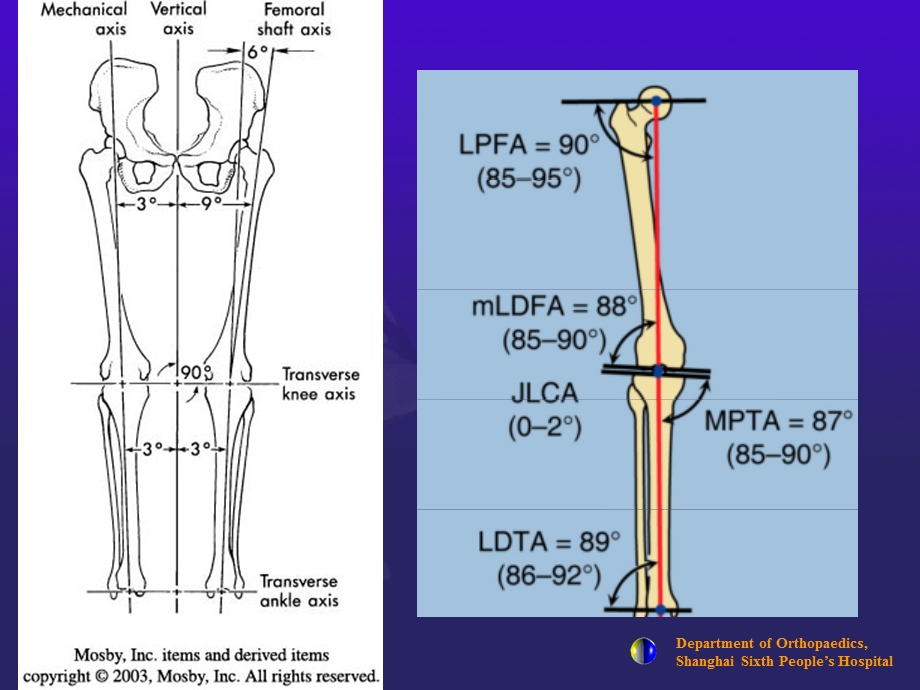 膝关节置换原理.ppt_第3页