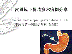 经皮胃镜下胃造瘘.ppt