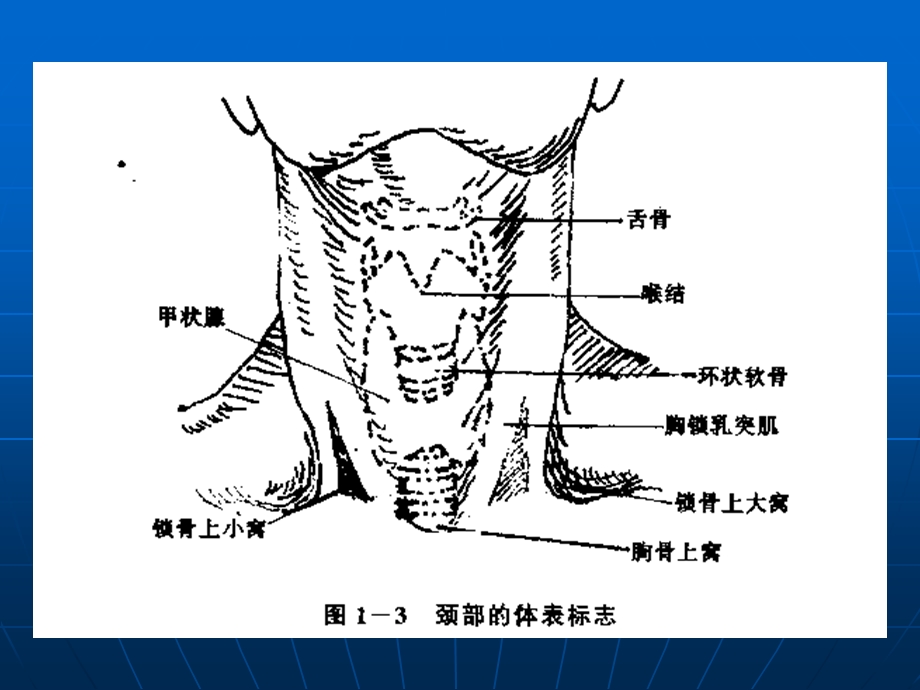 锁骨下静脉径路的技巧.ppt_第3页