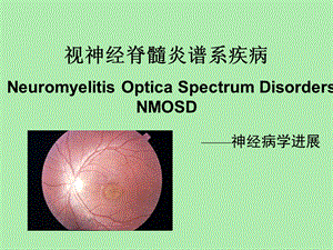 视神经脊髓炎谱系疾病.ppt