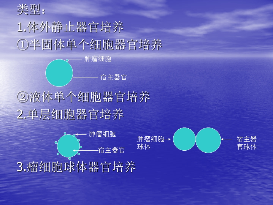 肿瘤细胞的侵袭和转移.ppt_第2页