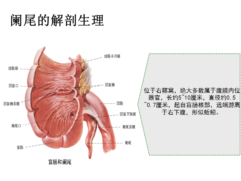 阑尾炎腹腔镜术前术后护理.ppt_第3页