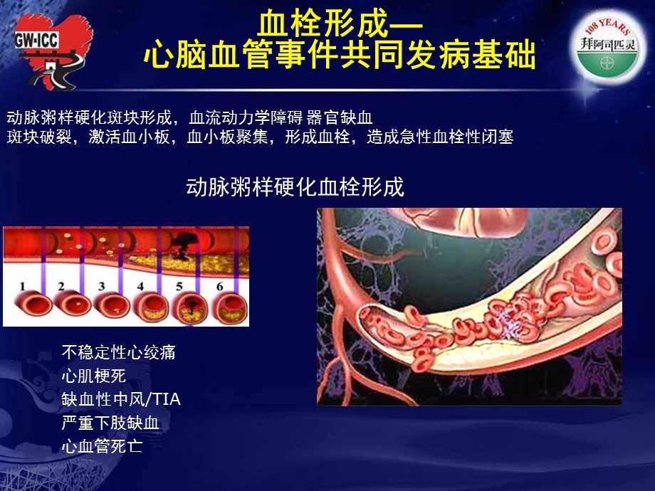 阿司匹林治疗进展.ppt_第3页