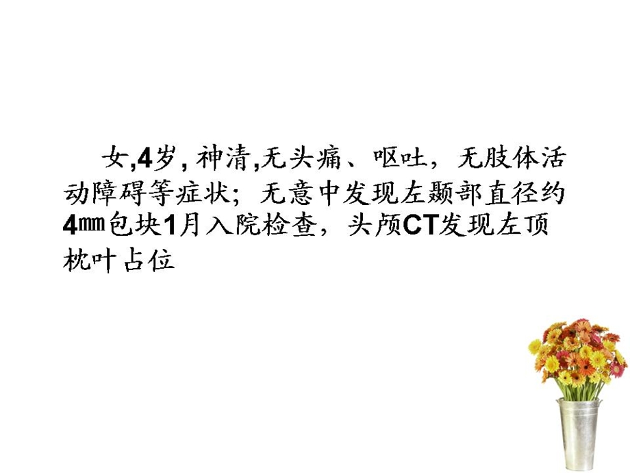 神经节细胞胶质瘤.ppt_第1页